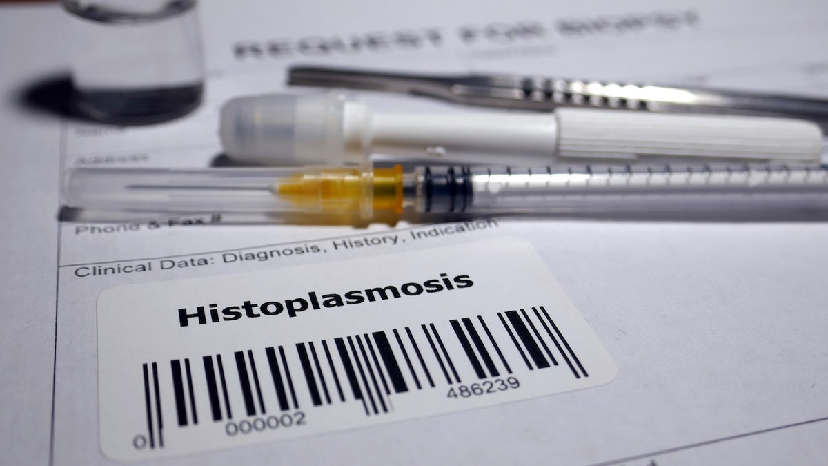Histoplasmosis test