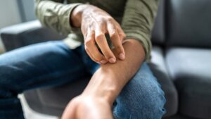 State confirms outbreak of sexually transmitted fungal infection, experts urge caution