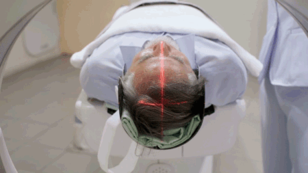 ‘Longevity gene’ may protect the brain from Alzheimer’s by boosting DNA repair, study finds