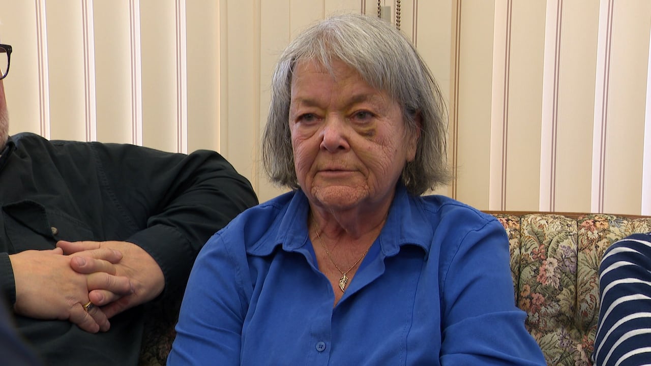 Janice is wearing a blue shirt and has a black eye from her fall earlier this year. 