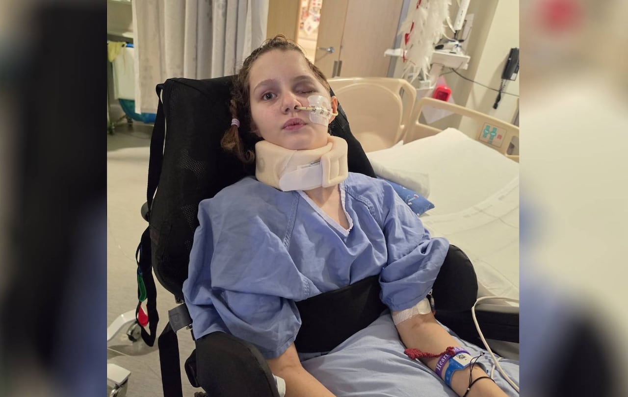 A young girl in a wheelchair in a hospital gown.