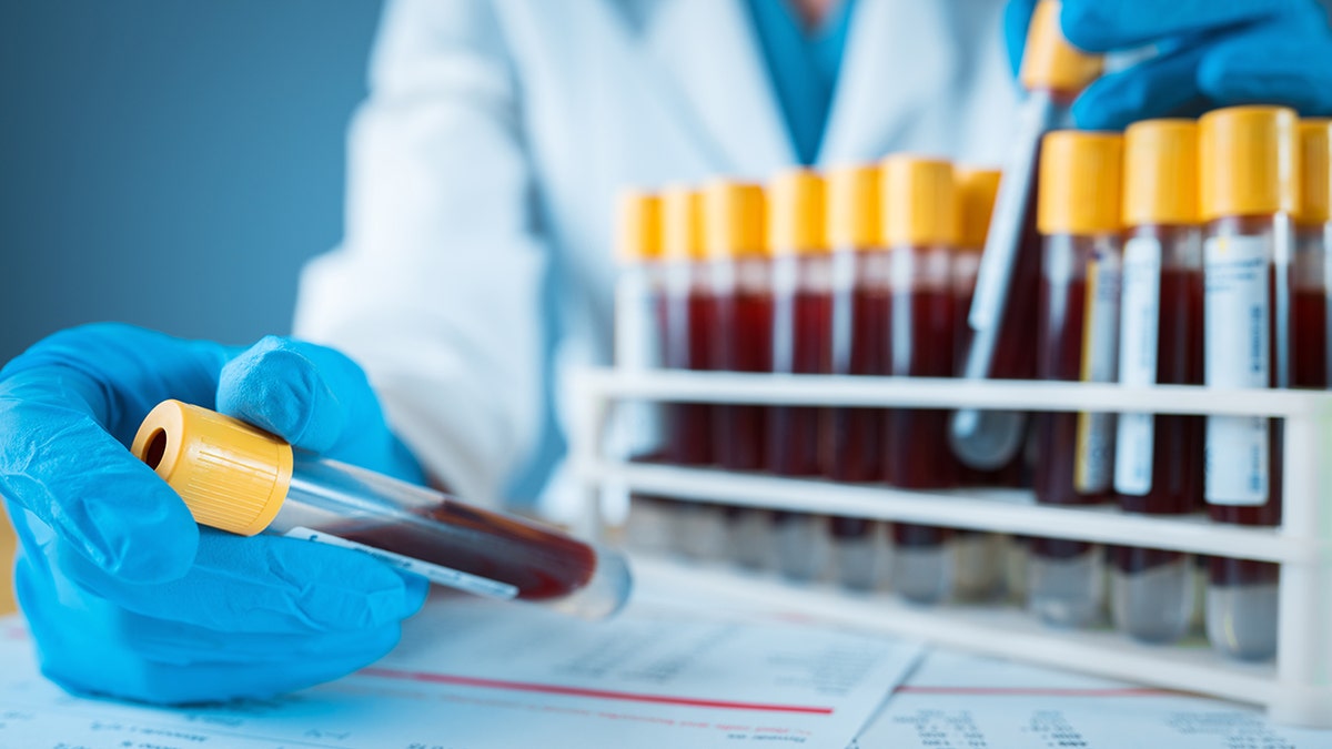 Lab expert holding vial of blood close to camera