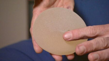 Advocates slam Health Canada’s new voluntary breast implant registry, MP ‘deeply disappointed’