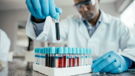 The ‘age’ of your blood could predict dementia risk, new study suggests