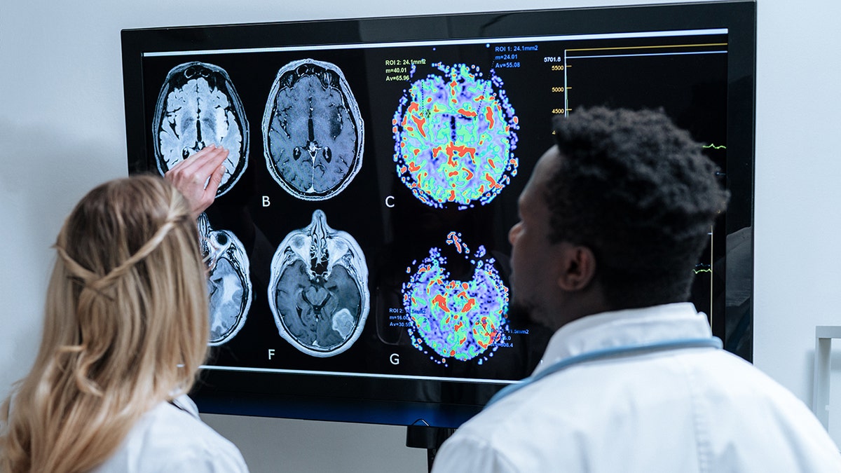 Female and male doctors examining a brain scan on a large screen