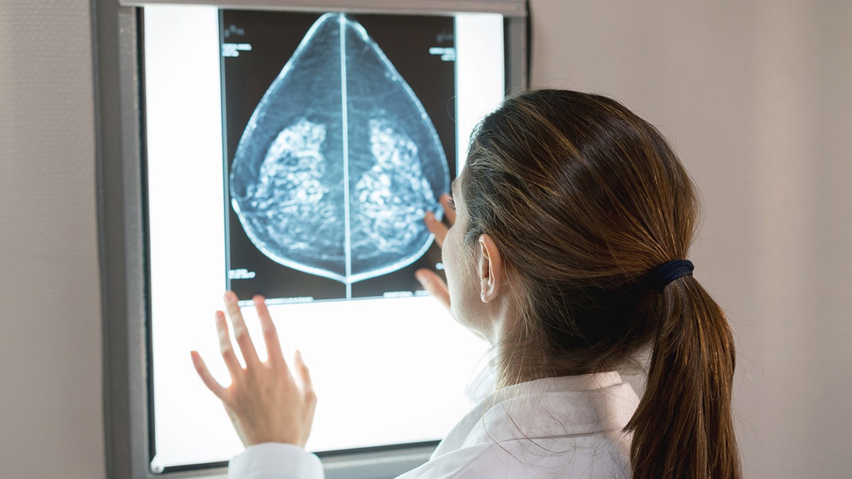 Gynecologist examining a patient's mammogram on a computer screen in a hospital.