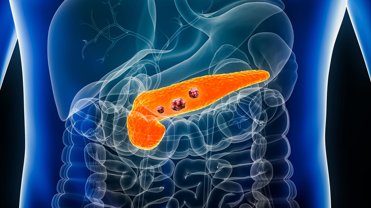 3D rendering of pancreatic cancer cells