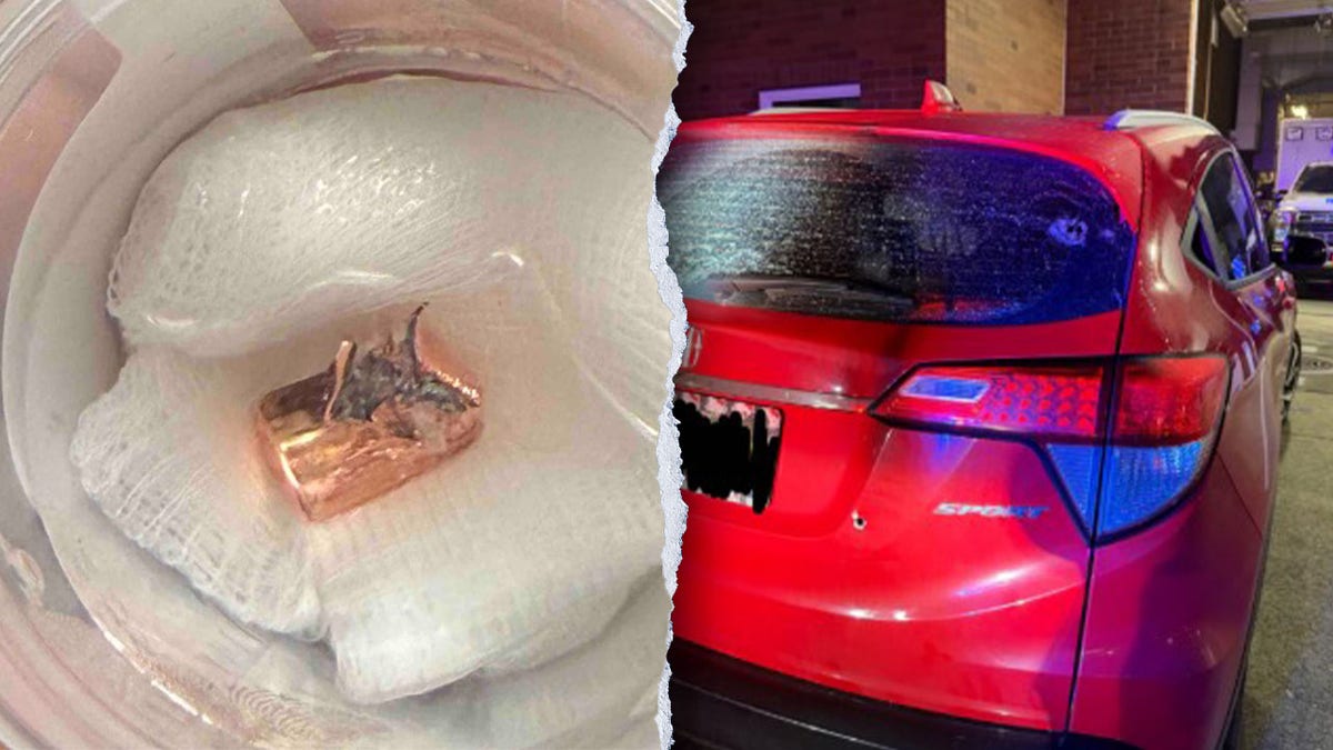A bullet taken from the head of Marcio Garcia. and a car.