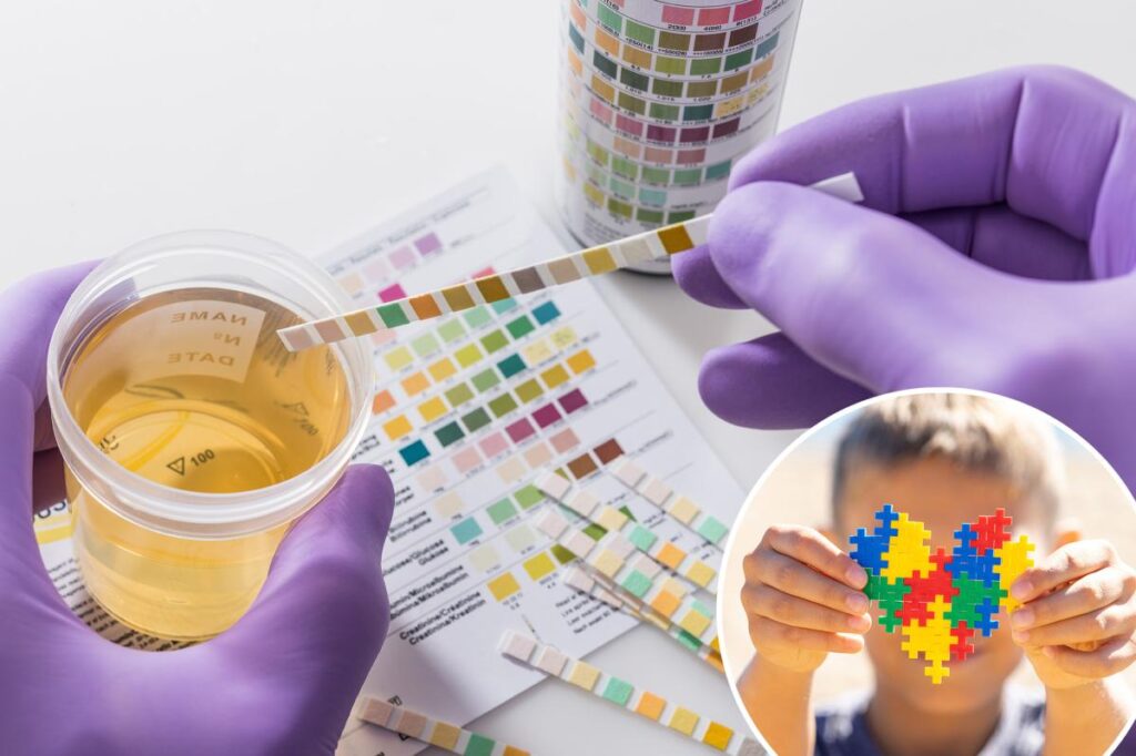 New urine test could diagnose autism in children: study