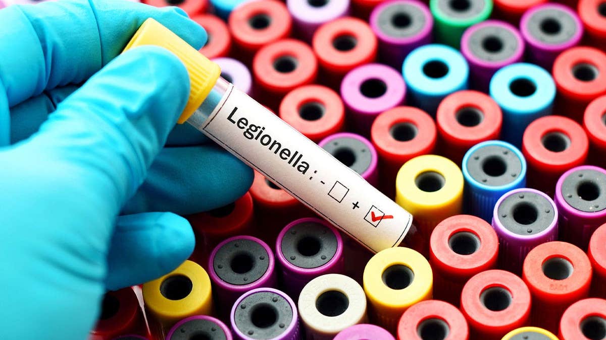 Blood sample showing a positive test result for Legionella bacteria