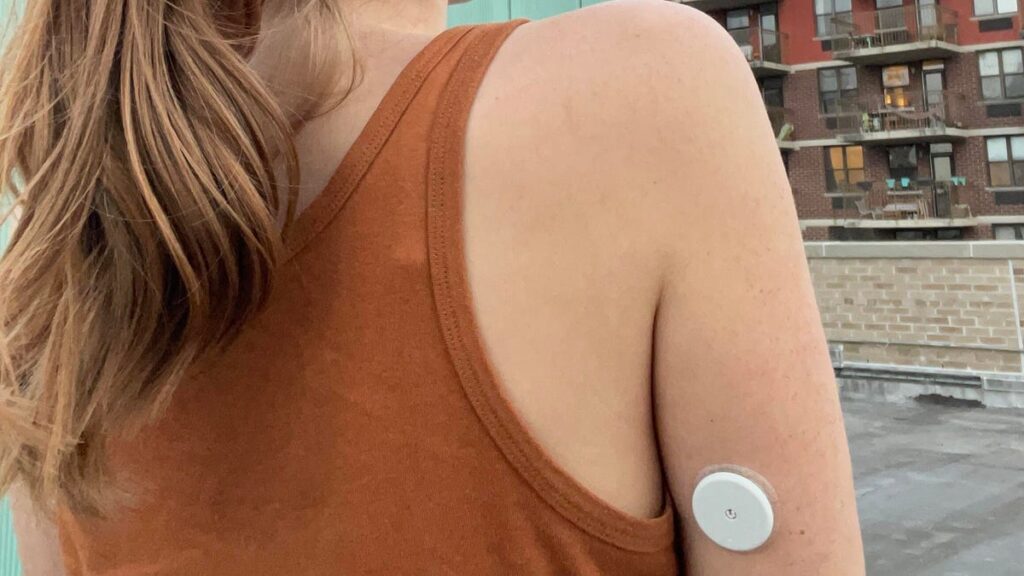 Best Continuous Glucose Monitors (CGM) for 2026