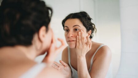 Skin condition under the eyes goes viral as doctors warn it could signal hidden health issue