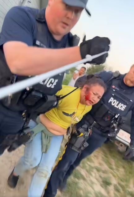 A woman is carried away by police with blood on her face and her hands behind her back.