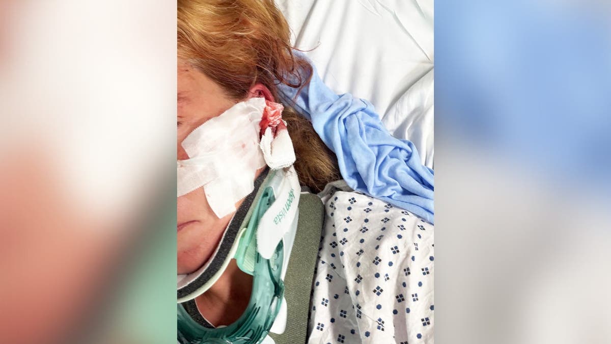 image shows victim with neck brace and bloodied bandages