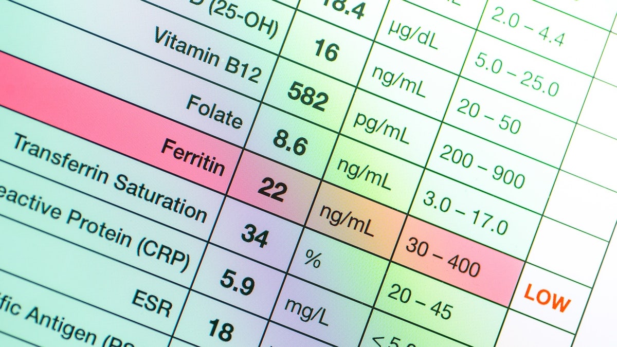 Ferritin levels