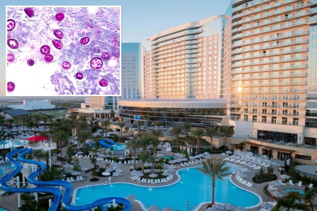 Highly contagious SoCal parasite outbreak linked to $1.3B resort pools under investigation