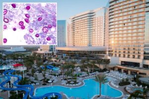 Highly contagious SoCal parasite outbreak linked to $1.3B resort pools under investigation